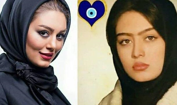 سحر قریشی قبل و بعد